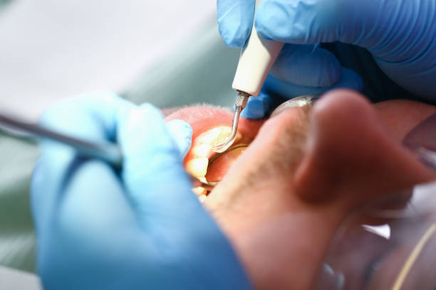 Best Mobile Emergency Dentist in Baxter Estates, NY